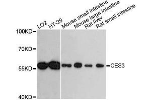Western blot analysis of extracts of various cell lines, using CES3 antibody. (CES3 Antikörper  (AA 269-568))