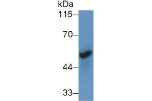 Detection of CHRNa7 in Mouse Cerebrum lysate using Polyclonal Antibody to Cholinergic Receptor, Nicotinic, Alpha 7 (CHRNa7) (CHRNA7 Antikörper  (AA 23-230))