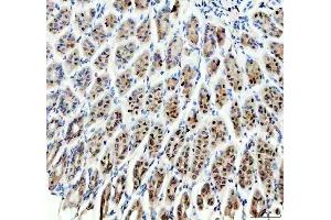 IHC analysis of SP6 using anti-SP6 antibody (ABIN5692945).