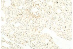 ABIN6264260 and ABIN6268782 at 1/100 staining Rat lung tissue by IHC-P.