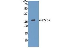 Detection of Recombinant GSTa4, Human using Polyclonal Antibody to Glutathione S Transferase A4 (GSTA4) (GSTA4 Antikörper  (AA 3-222))
