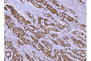 IHC analysis of ALDH1B1 using anti-ALDH1B1 antibody (ABIN4886450).