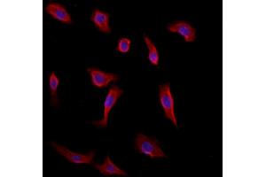 ABIN6260440 and ABIN6272875 staining HepG2 by IF/ICC. (CAMSAP2 Antikörper  (C-Term))