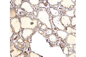 Immunohistochemistry (IHC) image for anti-Ectonucleotide Pyrophosphatase/phosphodiesterase 1 (ENPP1) (C-Term) antibody (ABIN185487)