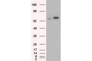 Western Blotting (WB) image for anti-Heat Shock 70kDa Protein 1A (HSPA1A) antibody (ABIN1498743) (HSP70 1A Antikörper)