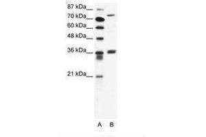 Image no. 1 for anti-Midline 1 (MID1) (AA 465-514) antibody (ABIN203238)