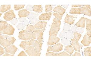 Detection of TNNI2 in Human Skeletal muscle Tissue using Polyclonal Antibody to Troponin I Type 2, Fast Skeletal (TNNI2) (TNNI2 Antikörper  (AA 1-182))