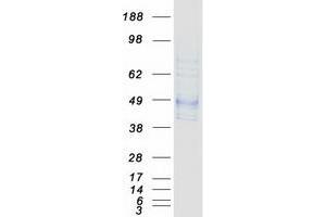 Western Blotting (WB) image for Neutral Cholesterol Ester Hydrolase 1 (NCEH1) protein (Myc-DYKDDDDK Tag) (ABIN2726887)
