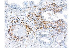 Immunohistochemistry (IHC) image for anti-Integrin, alpha X (Complement Component 3 Receptor 4 Subunit) (ITGAX) (AA 112-355) antibody (ABIN7449422)