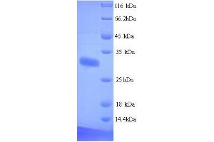 SDS-PAGE (SDS) image for delta-Like 1 Homolog (Drosophila) (DLK1) (AA 24-303) protein (His tag) (ABIN5713402)