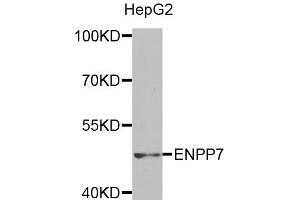 Western blot analysis of extracts of HepG2 cells, using ENPP7 antibody (ABIN5971506) at 1:400 dilution. (ENPP7 Antikörper)