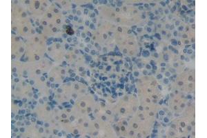 DAB staining on IHC-P; Samples: Rat Kidney Tissue (KRT12 Antikörper  (AA 398-456))