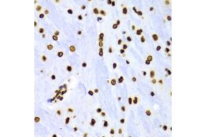 Immunohistochemistry of paraffin-embedded Rat brain using DiMethyl-Histone H3-K4 antibody (ABIN1872995) at dilution of 1:100 (40x lens). (Histone 3 Antikörper  (H3K4me2))