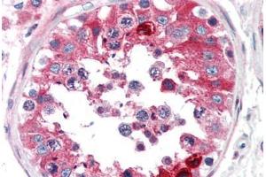 Human Testis (formalin-fixed, paraffin-embedded) stained with CLU antibody ABIN307177 at 5 ug/ml followed by biotinylated anti-mouse IgG secondary antibody ABIN481714, alkaline phosphatase-streptavidin and chromogen. (Clusterin Antikörper)