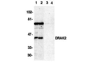 Western Blotting (WB) image for anti-serine/threonine Kinase 17b (STK17B) (C-Term) antibody (ABIN1030368) (DRAK2 Antikörper  (C-Term))