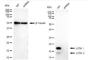 Western blotting analysis using MAP1LC3A antibody (ABIN7799409). (Rekombinanter MAP1LC3A Antikörper)