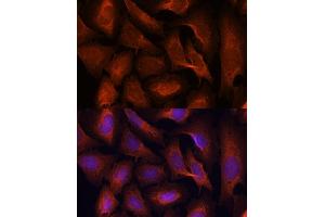 Immunofluorescence (IF) image for anti-Mucosa Associated Lymphoid Tissue Lymphoma Translocation Gene 1 (MALT1) (AA 125-450) antibody (ABIN3023032)