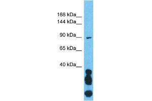Host:  Rabbit  Target Name:  OGT  Sample Type:  721_B Whole Cell lysates  Antibody Dilution:  1. (OGT Antikörper  (N-Term))