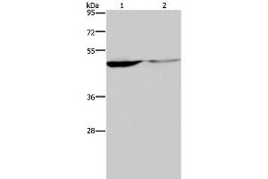 Western Blot analysis of Human paraneoplastic and normal kidney tissue using KCNK9 Polyclonal Antibody at dilution of 1:650