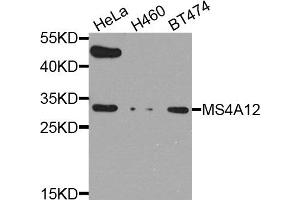 Western blot analysis of extract of various cells, using MS4A12 antibody. (MS4A12 Antikörper)