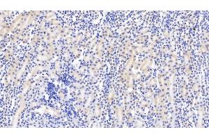 Detection of DTYMK in Mouse Kidney Tissue using Monoclonal Antibody to Deoxythymidylate Kinase (DTYMK) (DTYMK Antikörper  (AA 43-190))