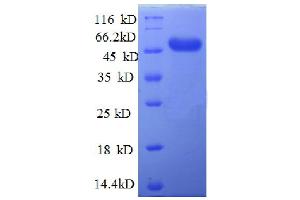 SDS-PAGE (SDS) image for AFG3-Like Protein 2 (AFG3L2) (AA 550-759), (partial) protein (GST tag) (ABIN5712331) (AFG3L2 Protein (AA 550-759, partial) (GST tag))