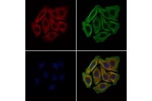 ABIN6265013 and ABIN6279108 staining Hela cells by IF/ICC. (alpha 2 Antiplasmin Antikörper  (C-Term))