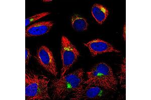 Image no. 1 for anti-Insulin-Like Growth Factor Binding Protein 7 (IGFBP7) antibody (ABIN181541) (IGFBP7 Antikörper)