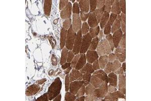 Immunohistochemical staining of human skeletal muscle with PFKM polyclonal antibody  shows strong cytoplasmic positivity in myocytes at 1:20-1:50 dilution. (PFKM Antikörper)