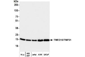 Western Blotting (WB) image for anti-Transmembrane Emp24-Like Trafficking Protein 10 (TMED10) (AA 25-75) antibody (ABIN7453220)