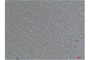 Immunohistochemistry (IHC) analysis of paraffin-embedded Human Brain Tissue using a-tubulin(Acetyl Lys40) Mouse Monoclonal Antibody diluted at 1:200. (alpha Tubulin Antikörper  (acLys40))