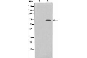 Western blot analysis on Jurkat cell lysate using DMPK Antibody,The lane on the left is treated with the antigen-specific peptide. (DMPK Antikörper  (N-Term))