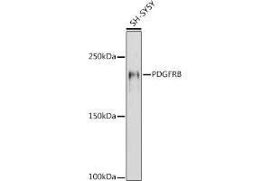 Western blot analysis of extracts of SH-SY5Y cells, using PDGFRB antibody (ABIN6134579, ABIN6145372 and ABIN7101437) at 1:1000 dilution.