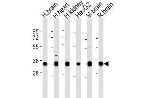 All lanes : Anti-KCNMB2 Antibody (N-term) at 1:2000 dilution Lane 1: human brain lysates Lane 2: human heart lysates Lane 3: human kidney lysates Lane 4: HepG2 whole cell lysates Lane 5: mouse brain lysates Lane 6: rat brain lysates Lysates/proteins at 20 μg per lane. (KCNMB2 Antikörper  (N-Term))