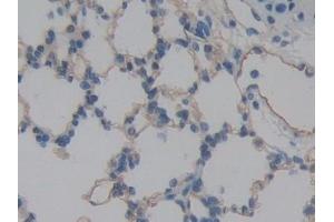 Immunohistochemistry (IHC) image for anti-Intercellular Adhesion Molecule 2 (ICAM2) (AA 29-247) antibody (ABIN7442924)