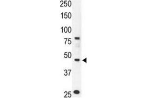 Western Blotting (WB) image for anti-Chemokine Binding Protein 2 (CCBP2) antibody (ABIN3001323) (CCBP2 Antikörper)