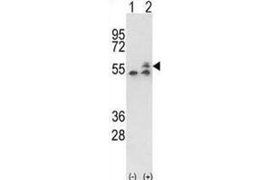 Western Blotting (WB) image for anti-ATP Synthase, H+ Transporting, Mitochondrial F1 Complex, beta Polypeptide (ATP5B) antibody (ABIN3001742) (ATP5B Antikörper)
