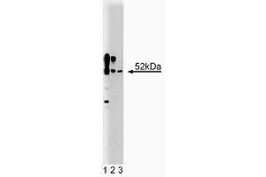 Western blot analysis of CaM Kinase II on a rat cerebrum lysate (First Panel). (CAMK2A Antikörper  (AA 448-460))