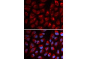 Immunofluorescence (IF) image for anti-Erythrocyte Membrane Protein Band 4.1 (Elliptocytosis 1, RH-Linked) (EPB41) antibody (ABIN1872554) (EPB41 Antikörper)