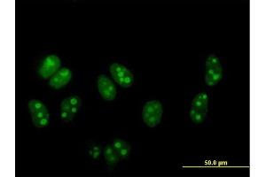 Immunofluorescence of purified MaxPab antibody to DDX54 on HeLa cell. (DDX54 Antikörper  (AA 1-881))