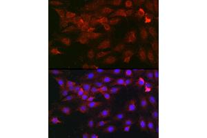 Immunofluorescence analysis of C6 cells using Heparanase 1 Rabbit pAb (ABIN6128033, ABIN6141977, ABIN6141978 and ABIN6221391) at dilution of 1:100 (40x lens). (HPSE Antikörper  (AA 36-275))