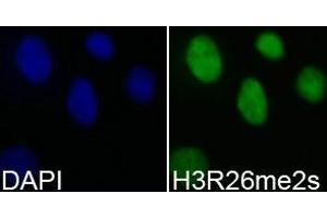 Immunofluorescence analysis of 293T cell using H3R26me2s antibody. (Histone 3 Antikörper  (H3R26me2s))