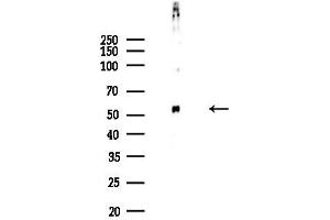 Western blot analysis of lysates from COLO205 cells, using Phospho-CDC25C (Ser216) Antibody at 1/1000 dilution.