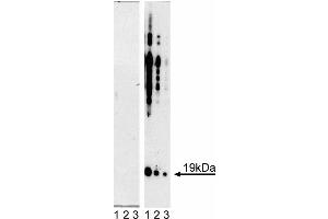 Western blot analysis of alpha-Synuclein (pY125). (SNCA Antikörper  (pTyr125, Tyr125))