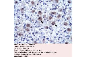 Human Brain (RNF141 Antikörper  (Middle Region))
