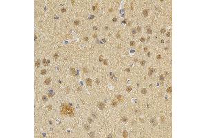 Immunohistochemistry of paraffin-embedded mouse brain using DNMT3A antibody at dilution of 1:200 (x400 lens) (DNMT3A Antikörper)