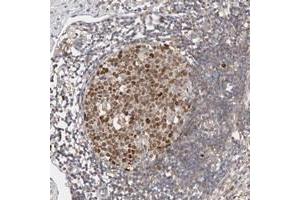 Immunohistochemical staining of human appendix with CDCA7L polyclonal antibody  shows strong nuclear positivity in lymphoid reaction center cells at 1:500-1:1000 dilution. (CDCA7L Antikörper)