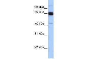 WB Suggested Anti-PRKAA1 Antibody Titration: 0. (PRKAA1 Antikörper  (N-Term))