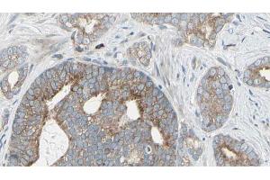 ABIN6268974 at 1/100 staining Human prostate tissue by IHC-P. (EIF4B Antikörper  (pSer422))
