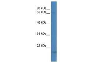 Image no. 1 for anti-Von Hippel-Lindau Tumor Suppressor, E3 Ubiquitin Protein Ligase (VHL) (AA 27-76) antibody (ABIN6747472) (VHL Antikörper  (AA 27-76))